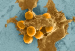 Superbugs up close: golden staph, as seen under a scanning electron microscope.