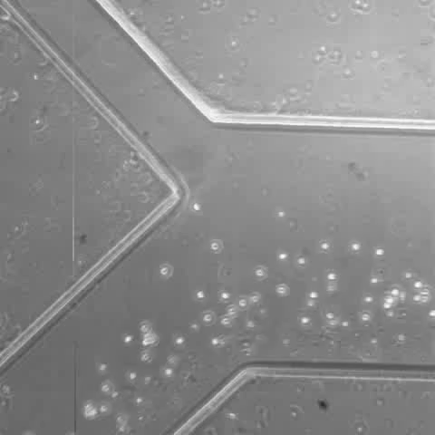 Isolation of Circulating Tumour Cells from a lung cancer patient (GIF)