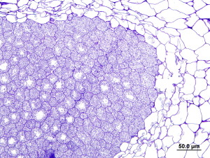 Micrograph of a root nodule of the African legume Listia angolensis inoculated with Microvirga lotononidis strain WSM3557. Plant cells inside the nodule are filled with dark blue, nitrogen-fixing Microvirga lotononidis rhizobia.