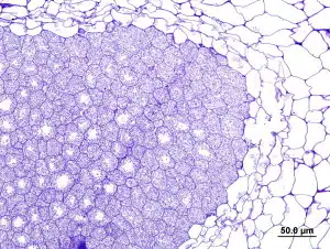 Micrograph of a root nodule of the African legume Listia angolensis inoculated with Microvirga lotononidis strain WSM3557. Plant cells inside the nodule are filled with dark blue, nitrogen-fixing Microvirga lotononidis rhizobia.